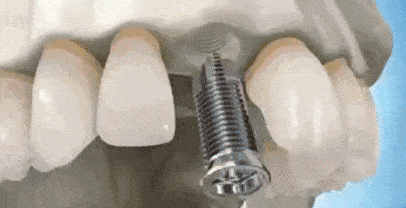 49073dfcb09e452a9fd055af35235ddb.gif