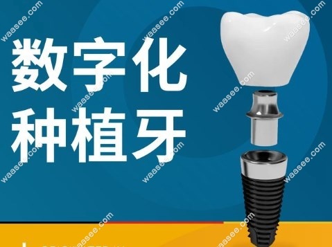南京茀莱堡口腔半全口种植牙多少钱m.waasee.com