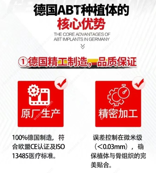 德国abt种植牙的核心优势