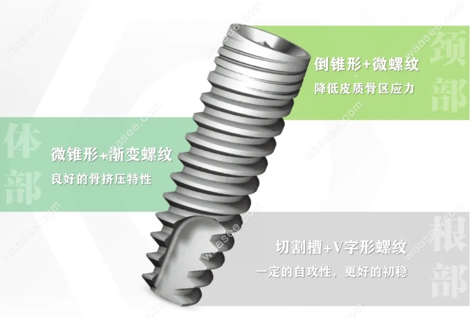 德国ABT种植牙设计