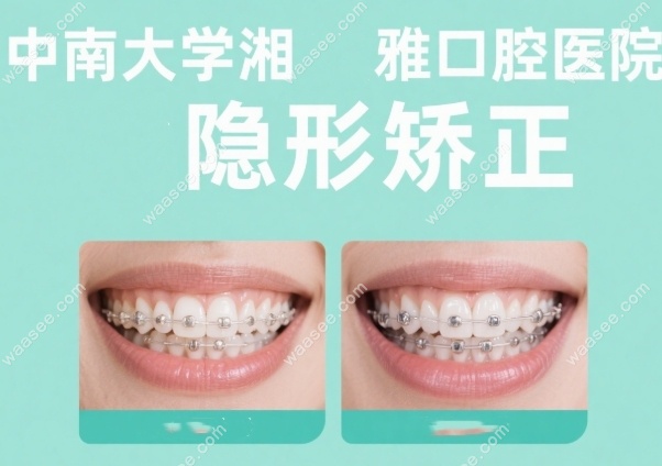 长沙湘雅口腔医院正畸价格