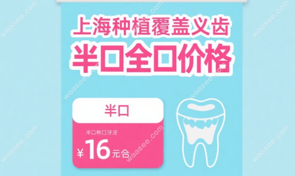 上海杆卡种植覆盖式义齿价格