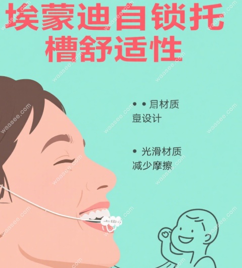 埃蒙迪自锁托槽舒适度