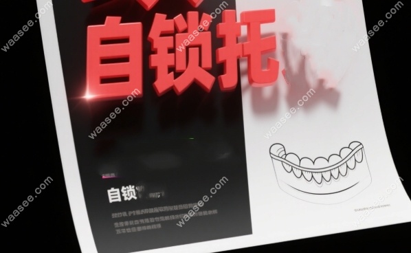 埃蒙迪自锁托槽优势