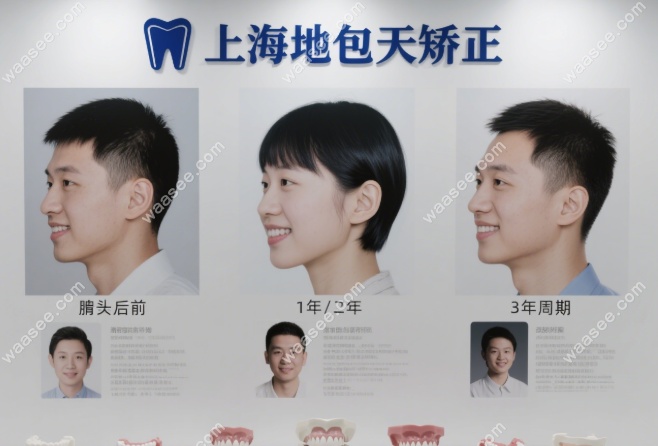 上海地包天矫正医院哪家好？这份10强医院实力测评给你答案