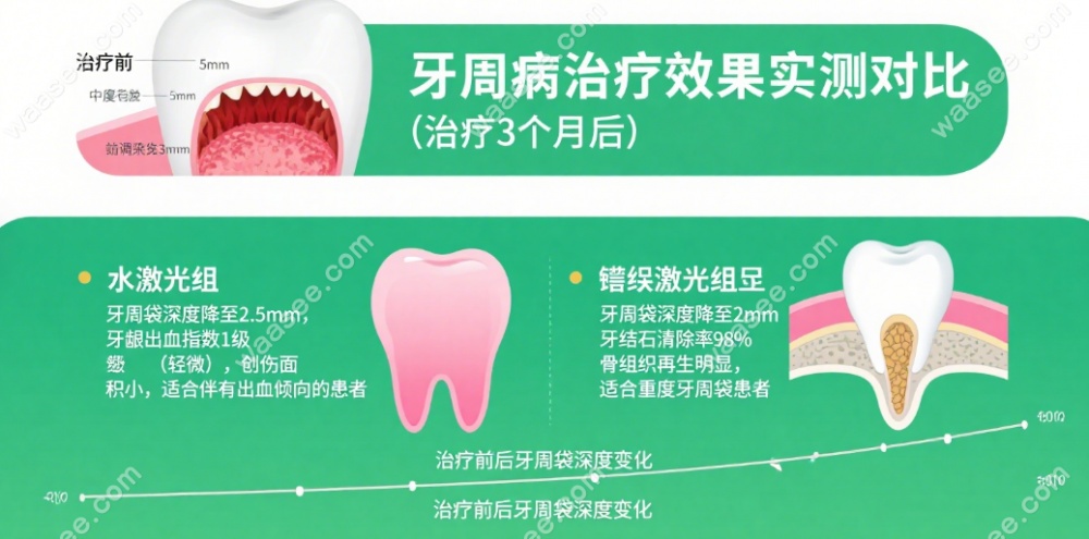 牙周病治疗实测