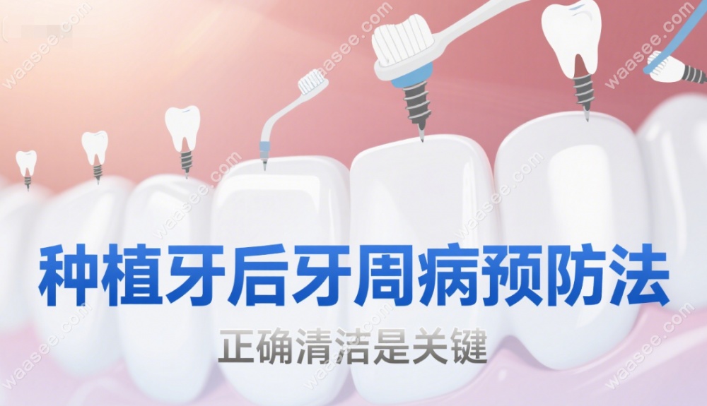 种植牙清洁的正确方法