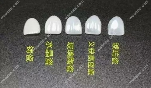 烤瓷牙