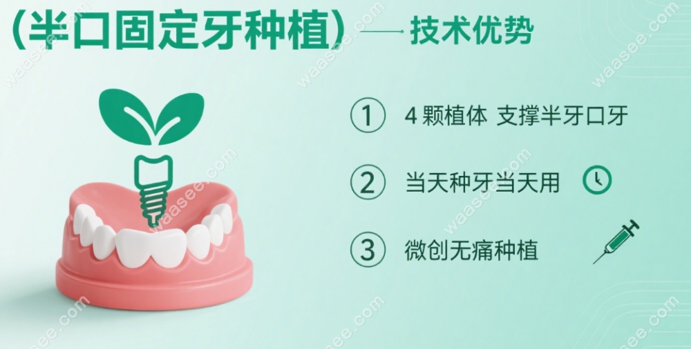 半口固定种植牙