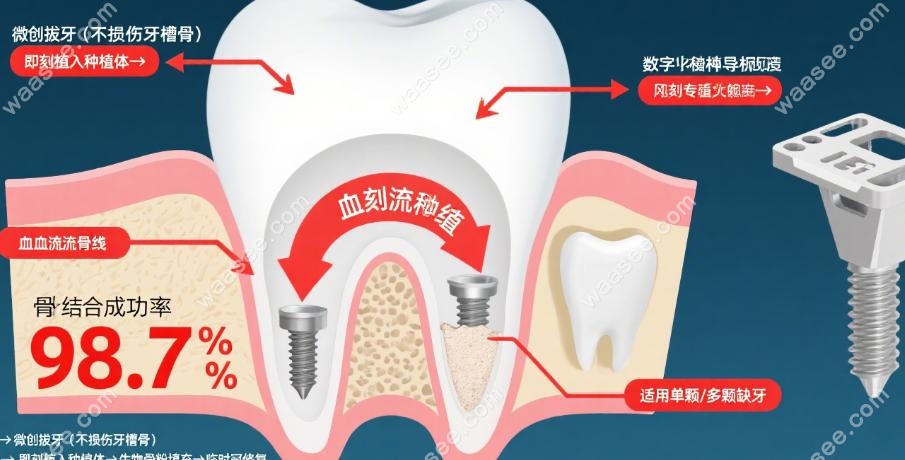 哪些情况决定了“德韩口腔医院种植牙当天能不能完成种植吗”
