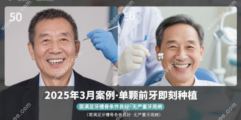 如何化实现“德韩口腔医院种植牙当天能不能完成种植吗”