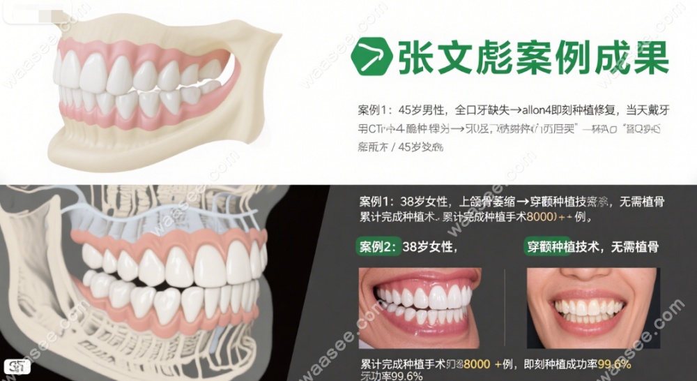 拜尔口腔有名三个医生介绍:深圳张文彪+成都曹静+佛山曾祥