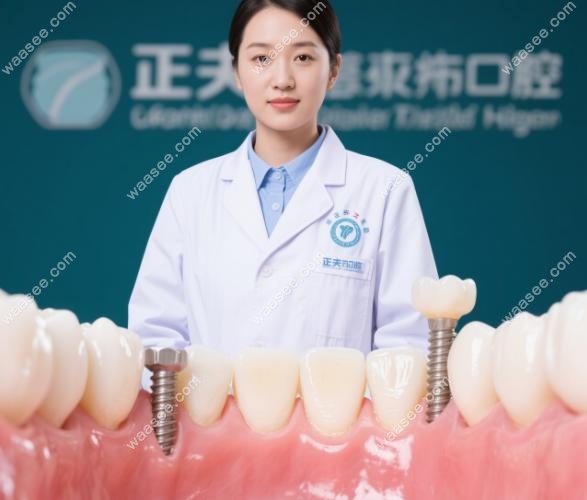 为何张帅玉的半口种植敢“3万起”
