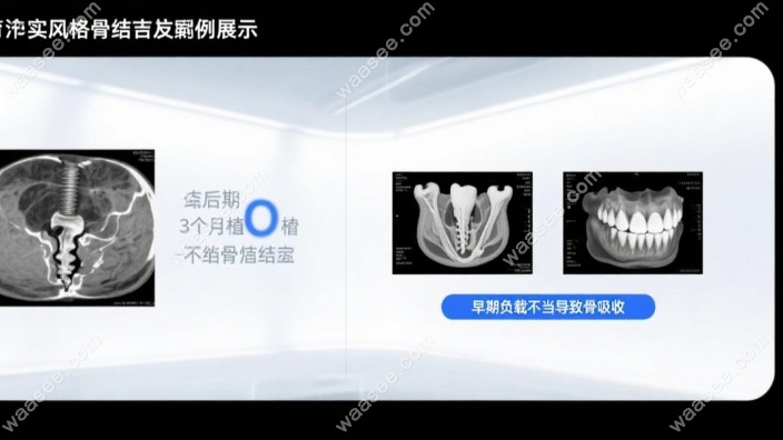种植牙失败病例