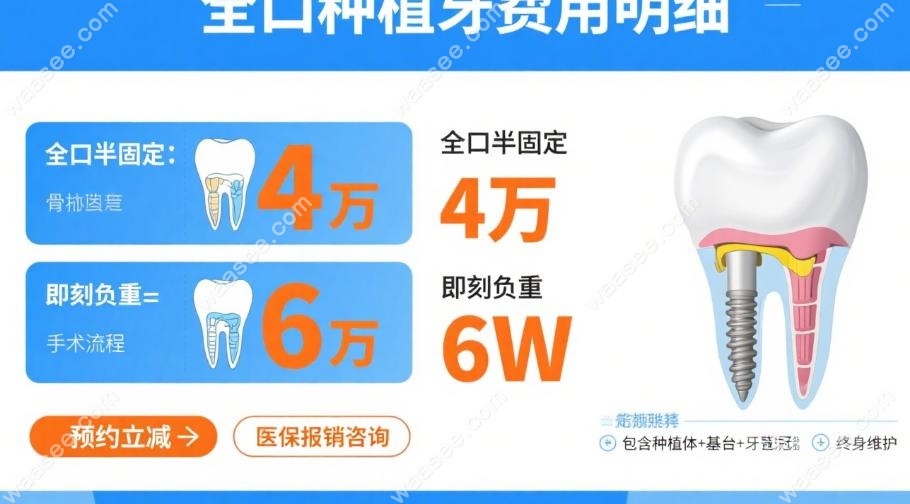 格伦菲尔口腔全口种植牙价格表:全口半固定4万,即刻负重6W