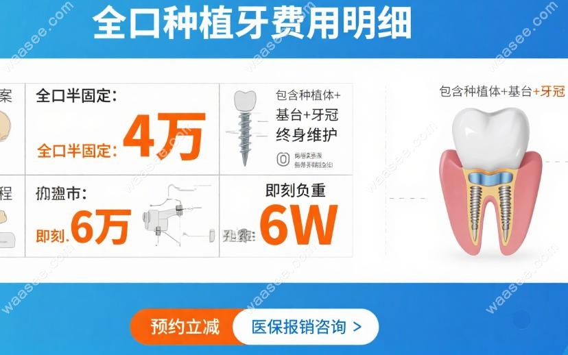 确保4万/6万套餐物超所值