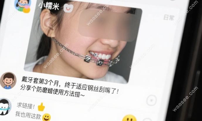牙齿矫正患者评论区