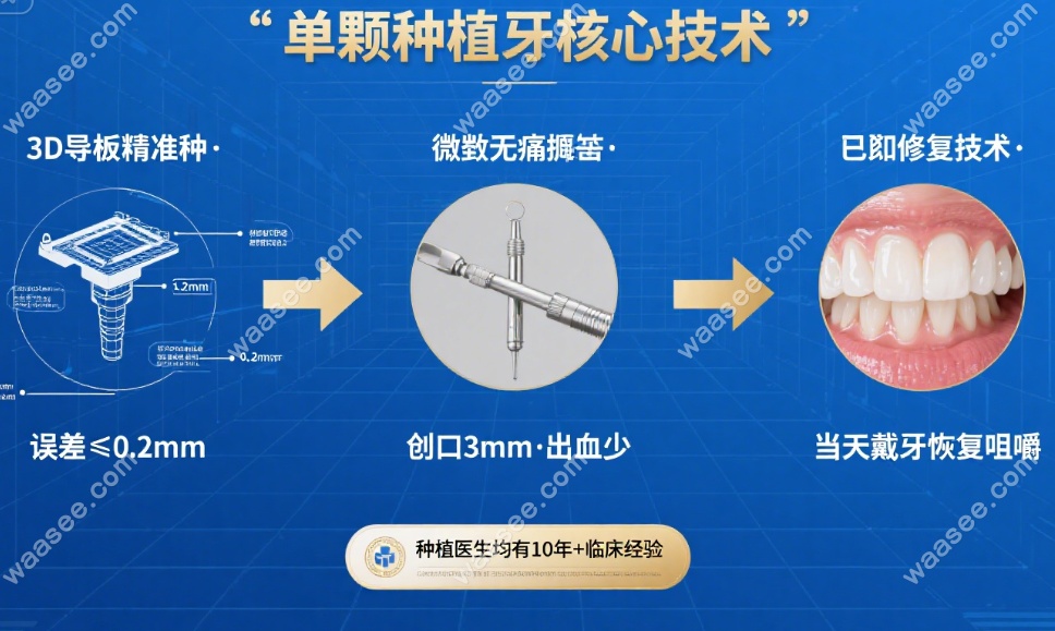 泰州中诺口腔医院种牙技术