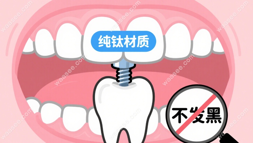 纯钛材质不发黑