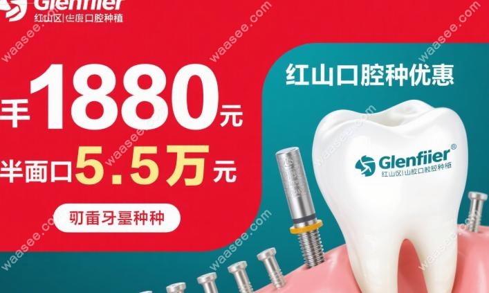 格伦菲尔红山口腔种牙优惠:登腾植体1580元,半口种植5.5万