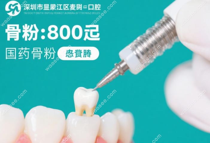 深圳沙井麦芽口腔植骨种牙价格9800起：技术优势详解