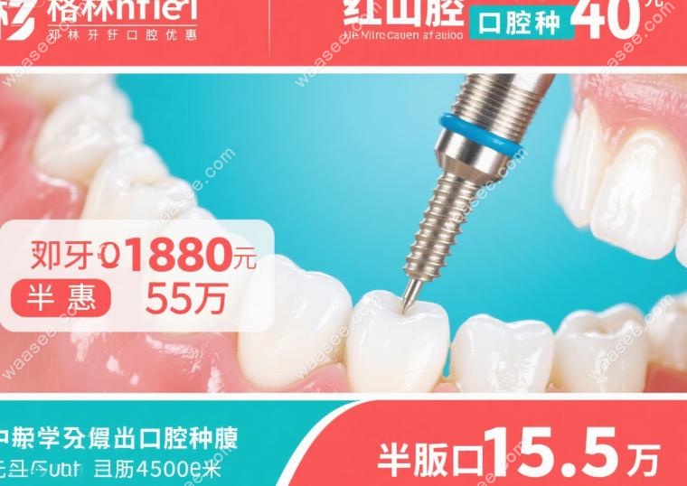 格伦菲尔红山口腔种牙优惠:登腾植体1580元,半口种植5.5万