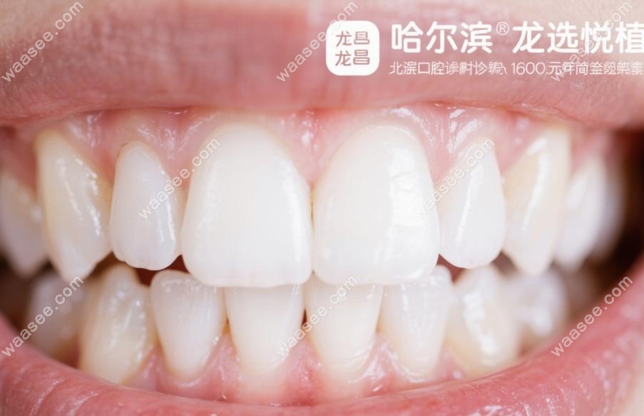 为啥我只推荐悦植和龙昌