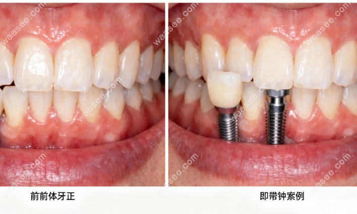 长春牙冠军口腔580元