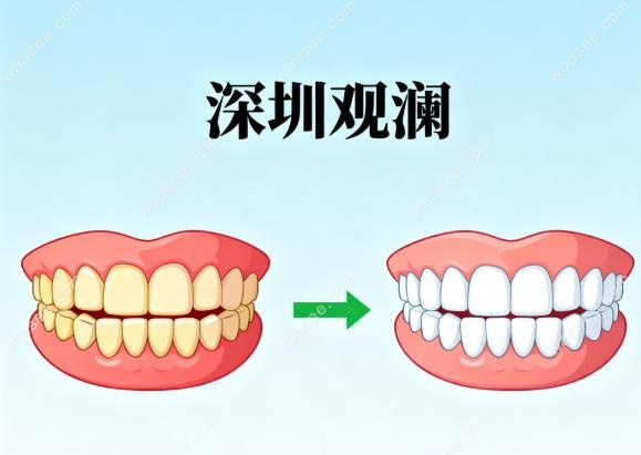 深圳观澜牙齿矫正哪家医院好?好评多&不踩雷分享!深森/博润