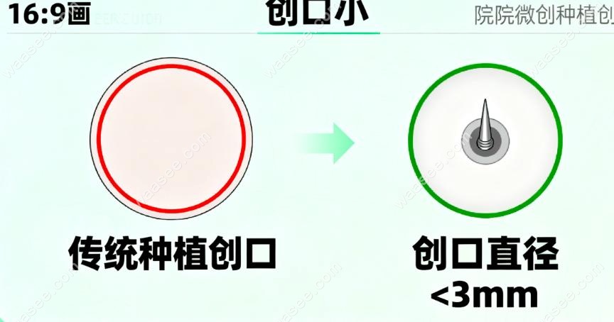 福能海峡口腔种植牙变好快
