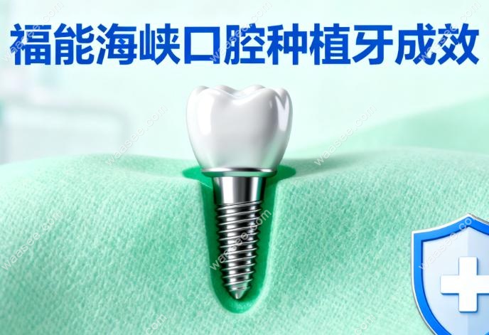 福能海峡口腔种植牙成效创口小+变好快+成功概率高+医生稳