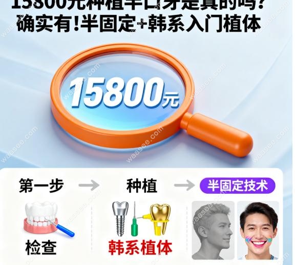半固定种植牙：它到底是啥