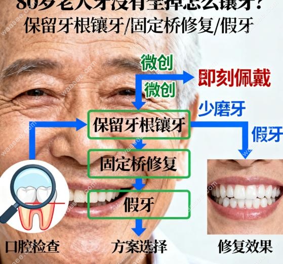 “搭桥”修复缺牙