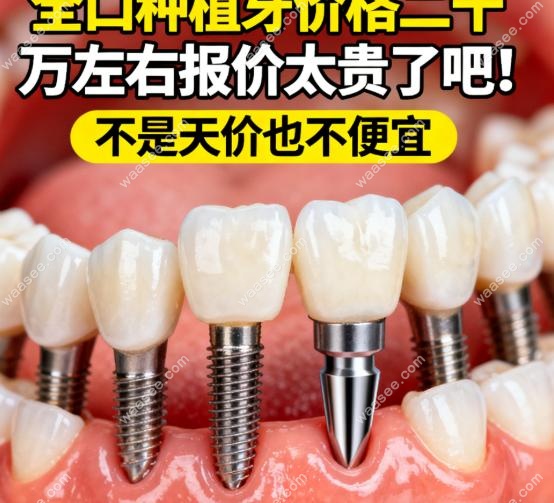 全口种植牙价格二十万左右报价太贵了吧!不是天价也不便宜