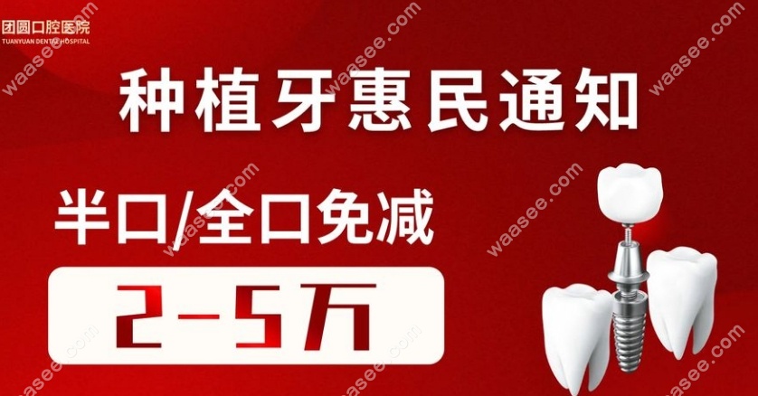 昆明团圆口腔全口种牙优惠 昆明团圆口腔全口种牙优惠