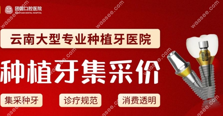 昆明团圆口腔种牙优惠 昆明团圆口腔种牙优惠