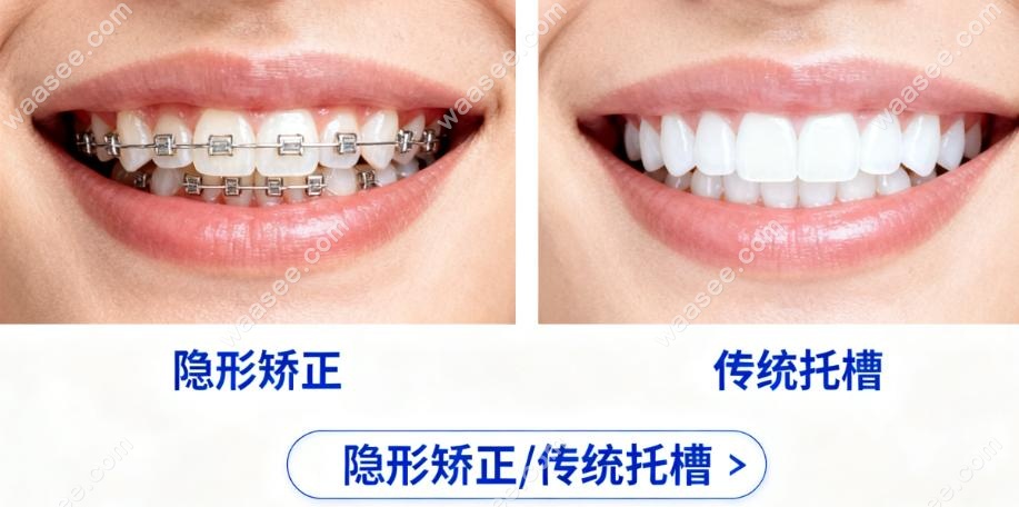 深圳松鼠口腔医院整牙怎么样？不同人群适配，价格还透明