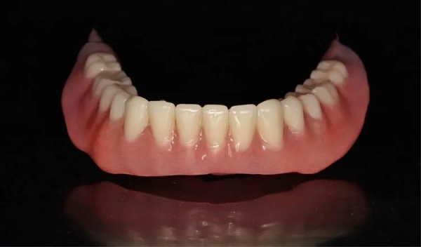 上海瑞凡口腔吸附性义齿全口价格