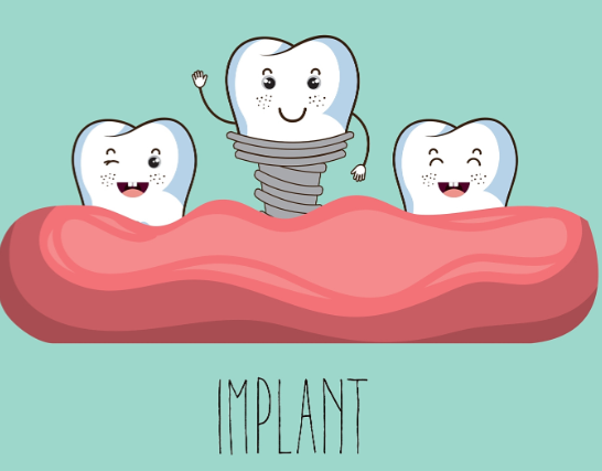 深圳全口种植便宜多少钱