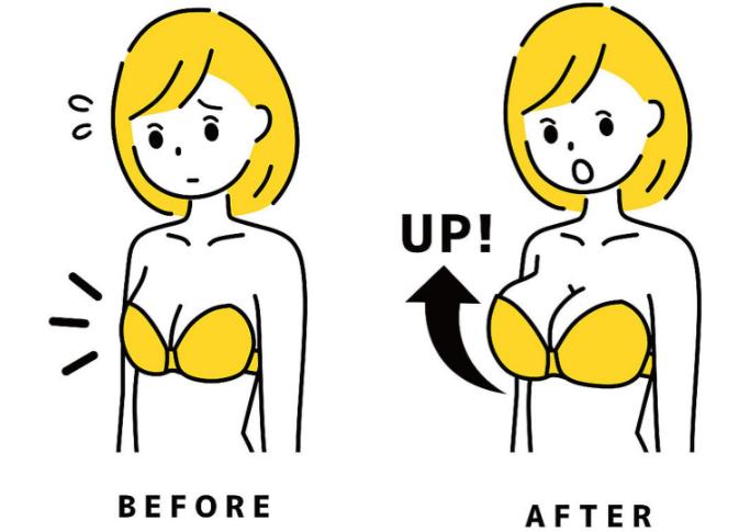 王明利自体脂肪隆胸