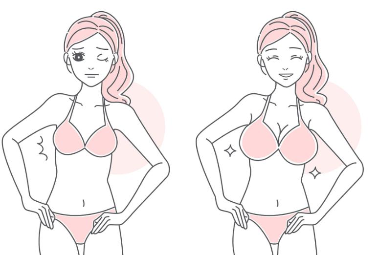 自体脂肪隆胸前后对比图