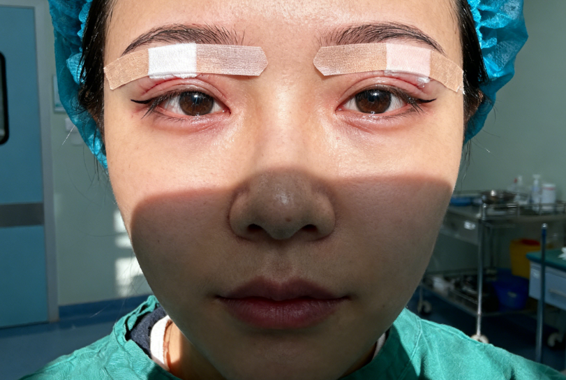 杭州5家醫(yī)院雙眼皮價格及醫(yī)生對比