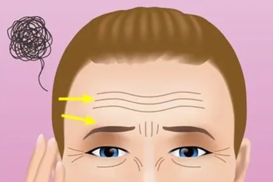 謝宏彬拉皮手術(shù)